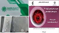 انجام اولین نمونه گیری به صورت رپیت تست با استفاده از کیت تشخیص سریع کیفی آنتی ژن SARS-COV-2