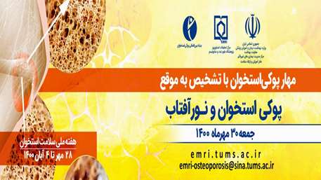  پوکی استخوان و نور آفتاب 